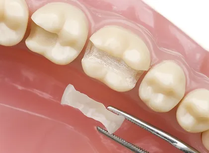 Restorative Dentistry -01