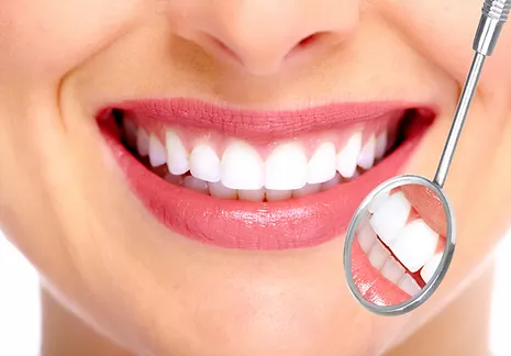 Teeth Whitening -01